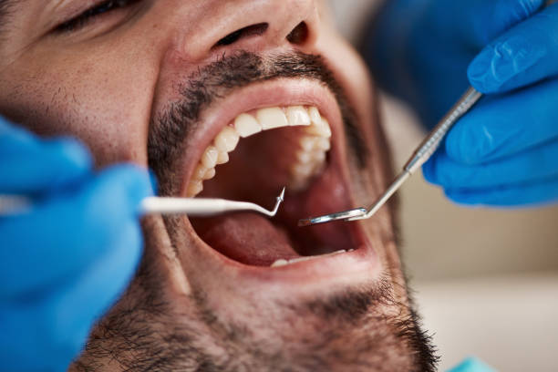 Best Cosmetic Emergency Dentistry in Oberlin, LA